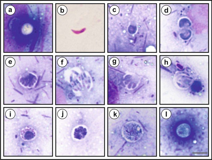 Animal contact linked to large Cryptosporidium outbreak